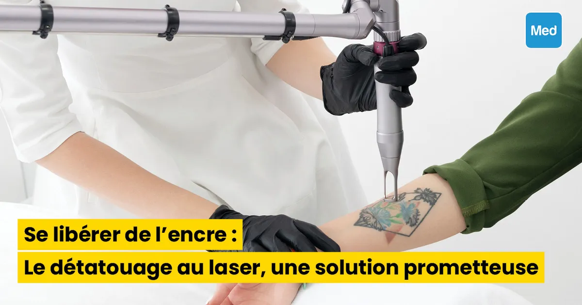 Se libérer de l'encre : Le détatouage au laser, une solution prometteuse